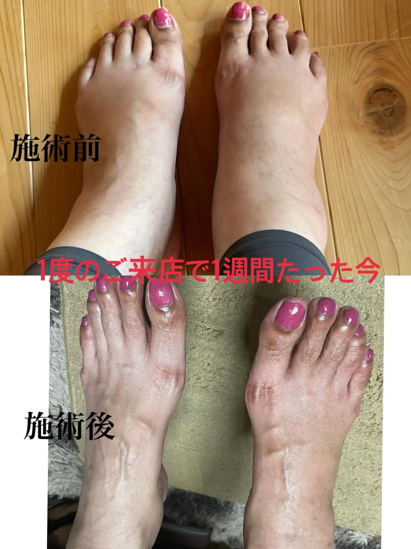 🌿むくみでお悩みのお客様🌿