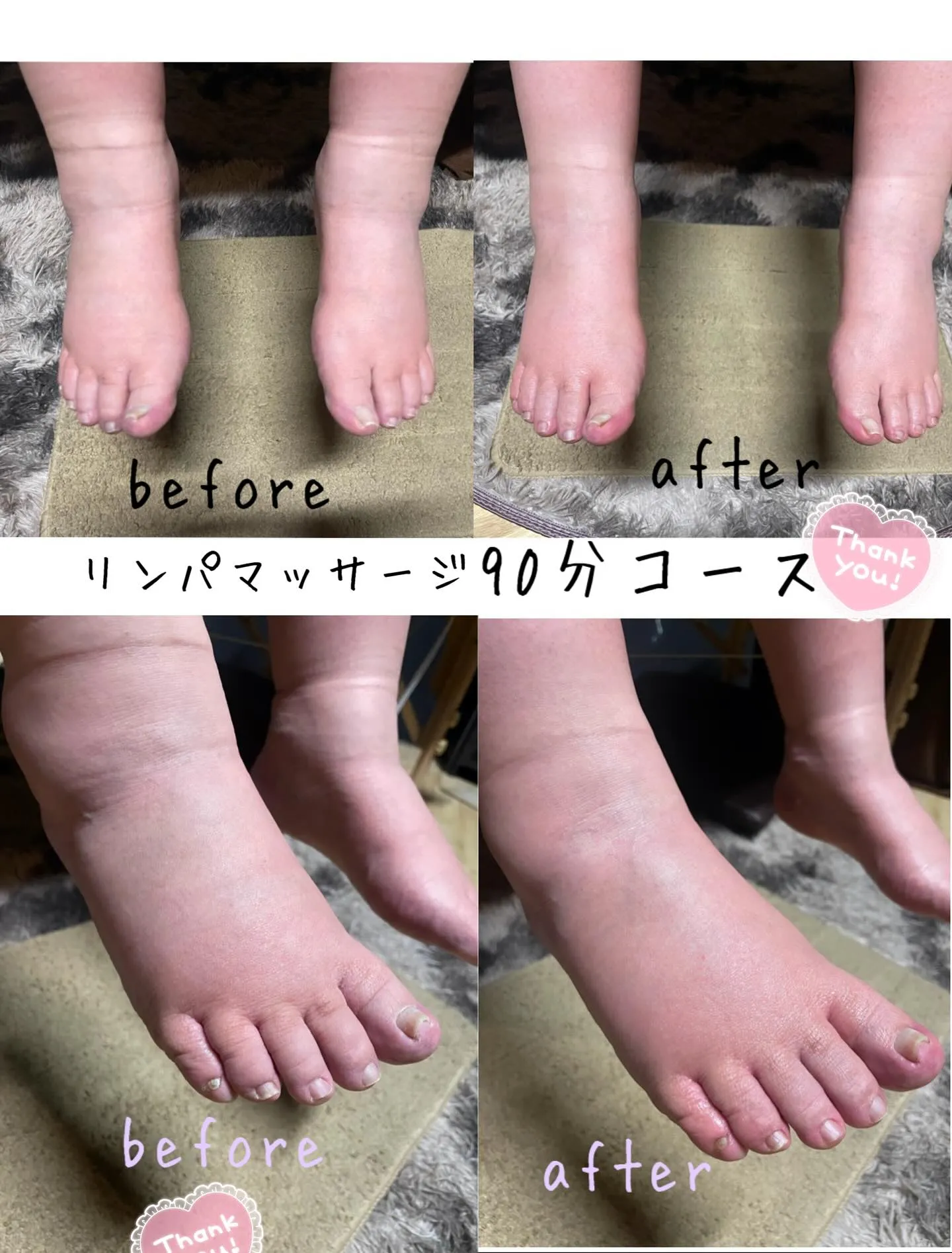 #90分コース #リンパマッサージ